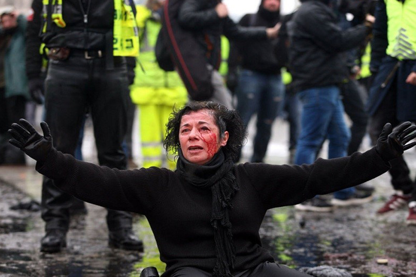 أزمة الستر الصفراء: قراءة معمقة في مسببات الأزمة